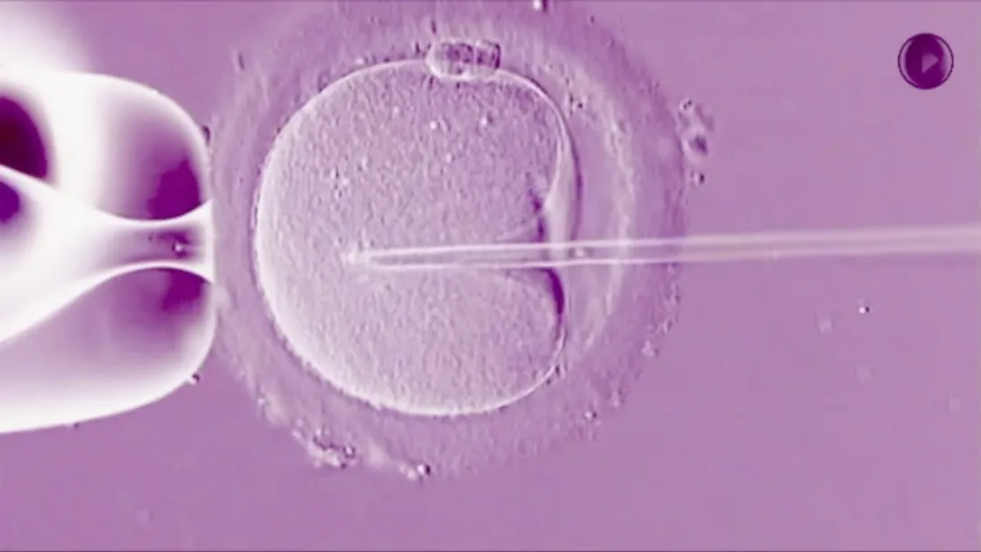  ICSI-IVF