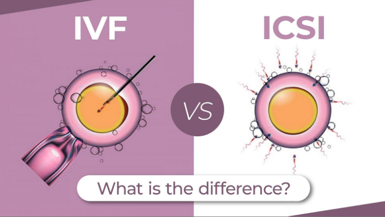 IVF vs ICSI eraya fertility