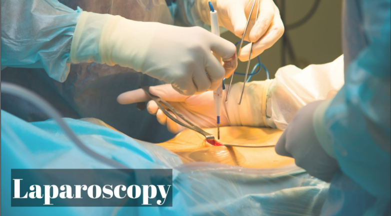 Laproscopy Eraya Fertility